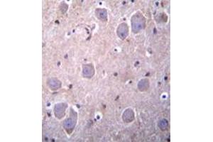 Formalin fixed, paraffin embedded human brain tissue stained with RAP1GDS1 Antibody  followed by peroxidase conjugation of the secondary antibody and DAB staining. (RAP1GDS1 antibody  (Middle Region))