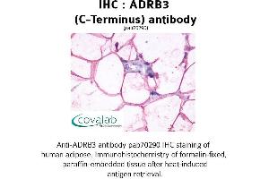 Image no. 1 for anti-Adrenergic, beta-3-, Receptor (ADRB3) (C-Term) antibody (ABIN1731585) (ADRB3 antibody  (C-Term))