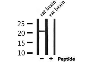 Western blot analysis of extracts from rat brain, using TMEM37 Antibody. (TMEM37 antibody  (N-Term))