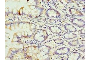 Immunohistochemistry of paraffin-embedded human small intestine tissue using ABIN7152051 at dilution of 1:100 (SULT1E1 antibody  (AA 140-294))