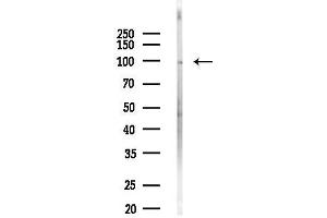 Western blot analysis of lysates from HepG2 cells(heat-shock,45 min treatment), using TRPV4 Antibody at 1/1000 dilution.