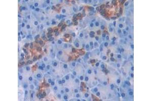 IHC-P analysis of Human Tissue, with DAB staining. (CXCL2 antibody  (AA 34-107))