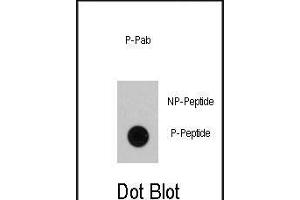 Dot blot analysis of anti-RAF1 Phospho-specific Pab (ABIN389895 and ABIN2839736) on nitrocellulose membrane. (RAF1 antibody  (pSer339))