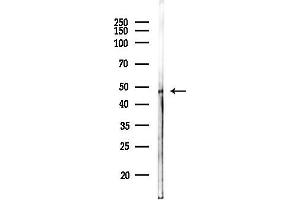 anti-serum/glucocorticoid Regulated Kinase 1 (SGK1) antibody