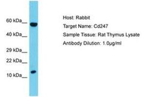 Image no. 1 for anti-CD247 Molecule (CD247) (C-Term) antibody (ABIN6750408) (CD247 antibody  (C-Term))