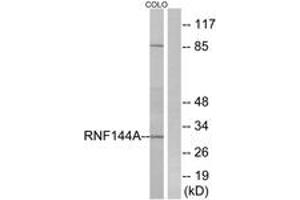 Western blot analysis of extracts from COLO cells, using RNF144A Antibody. (RNF144A antibody  (AA 151-200))