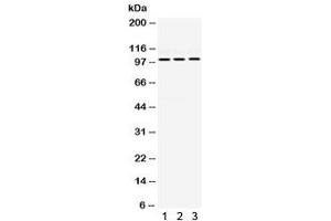 Western blot testing of human 1) HeLa, 2) MCF7 and 3) SMMC cell lysate with RASGAP antibody.