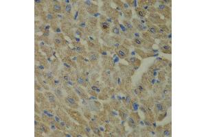 Immunohistochemistry of paraffin-embedded mouse heart using CCBL1 antibody at dilution of 1:100 (x40 lens). (CCBL1 antibody)