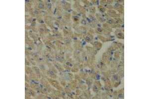 Immunohistochemistry of paraffin-embedded mouse heart using CCBL1 antibody at dilution of 1:100 (x40 lens). (CCBL1 antibody)