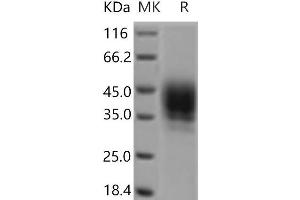 Western Blotting (WB) image for CD48 (CD48) protein (His tag) (ABIN7321147) (CD48 Protein (CD48) (His tag))