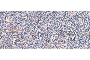 Immunohistochemistry of paraffin-embedded Human tonsil tissue using INSM2 Polyclonal Antibody at dilution of 1:35(x200) (INSM2 antibody)