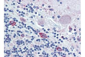 Brain, cerebellum, Human: Formalin-Fixed, Paraffin-Embedded (FFPE) (PDIA4 antibody  (AA 623-638))