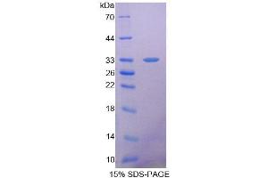 SDS-PAGE (SDS) image for Succinate Dehydrogenase Complex, Subunit A, Flavoprotein (Fp) (SDHA) (AA 4-300) protein (His tag) (ABIN4990848)