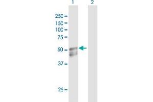 Western Blot analysis of GAL3ST1 expression in transfected 293T cell line by GAL3ST1 MaxPab polyclonal antibody. (GAL3ST1 antibody  (AA 1-423))