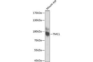 Western blot analysis of extracts of mouse eye, using TMC1 antibody (ABIN6134923, ABIN6149240, ABIN6149242 and ABIN6224704) at 1:1000 dilution. (TMC1 antibody  (AA 600-700))