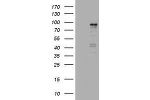 Image no. 1 for anti-Nibrin (NBN) (AA 461-754) antibody (ABIN1491541) (Nibrin antibody  (AA 461-754))