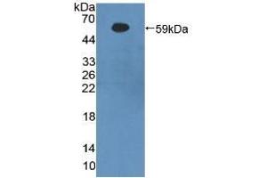 Detection of Recombinant bACE1, Human using Polyclonal Antibody to Beta-Site APP Cleaving Enzyme 1 (bACE1) (BACE1 antibody  (AA 170-428))