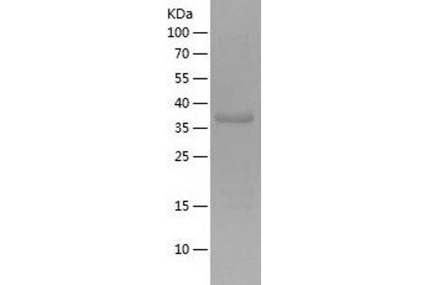 NFATC3 Protein (AA 187-313) (His-IF2DI Tag)