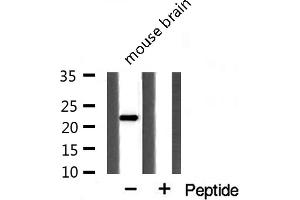 Western blot analysis of extracts from mouse Brian cells using PPIF antibody. (PPIF antibody  (Internal Region))