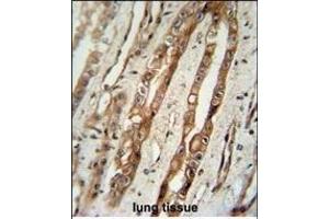 Immunohistochemistry (Paraffin-embedded Sections) (IHC (p)) image for anti-Serpin Peptidase Inhibitor, Clade G (C1 Inhibitor), Member 1 (SERPING1) (AA 285-314) antibody (ABIN390620)