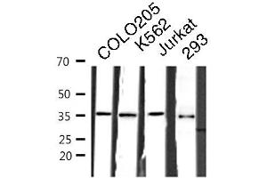 Western blot analysis of COLO205/K562/JURKAT/293 cell lysates using RNF113B antibody. (RNF113B antibody  (Internal Region))