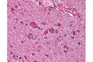 Anti-CHRNB3 antibody IHC of human brain, cortex. (CHRNB3 antibody  (AA 176-225))