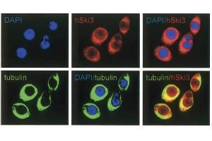 Immunofluorescence Microscopy of anti-SKI3 antibody Immunofluorescence Microscopy results of Rabbit anti-SKI3 antibody. (TTC37 antibody)