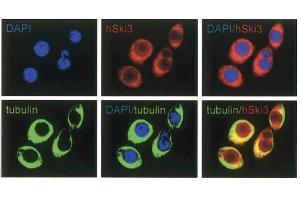 Immunofluorescence Microscopy of anti-SKI3 antibody Immunofluorescence Microscopy results of Rabbit anti-SKI3 antibody. (TTC37 antibody)