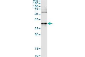 Immunoprecipitation of ANXA3 transfected lysate using anti-ANXA3 monoclonal antibody and Protein A Magnetic Bead , and immunoblotted with ANXA3 MaxPab rabbit polyclonal antibody. (Annexin A3 antibody  (AA 1-323))