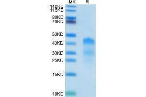 Human RGMa on Tris-Bis PAGE under reduced condition. (RGMA Protein (AA 48-422) (His-Avi Tag))