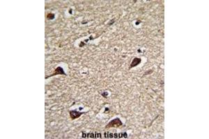 Immunohistochemistry (IHC) image for anti-6-phosphogluconolactonase (PGLS) antibody (ABIN3001729) (PGLS antibody)