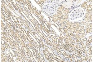 Immunohistochemical analysis of paraffin-embedded Human kidney section using Pink1 am2250b. (BBS4 antibody  (AA 1-240))
