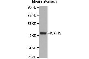 Western Blotting (WB) image for anti-Keratin 19 (KRT19) (AA 241-400) antibody (ABIN3020779) (Cytokeratin 19 antibody  (AA 241-400))