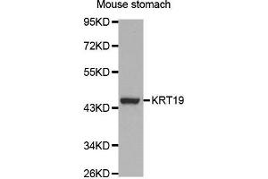 Western Blotting (WB) image for anti-Keratin 19 (KRT19) (AA 241-400) antibody (ABIN3020779) (Cytokeratin 19 antibody  (AA 241-400))