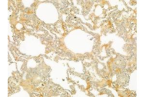ABIN6265013 and ABIN6279108 at 1/100 staining human normal lung tissue by IHC-P. (alpha 2 Antiplasmin antibody  (C-Term))
