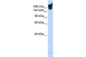 WB Suggested Anti-DYSF Antibody Titration:  0. (Dysferlin antibody  (Middle Region))