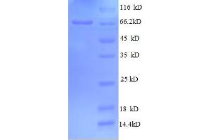 SDS-PAGE (SDS) image for Golgi Membrane Protein 1 (GOLM1) (AA 36-401), (partial) protein (GST tag) (ABIN5712746) (GOLM1 Protein (AA 36-401, partial) (GST tag))