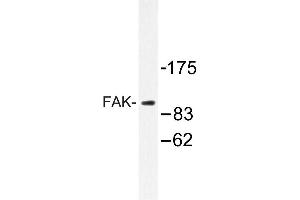 Image no. 1 for anti-PTK2 Protein tyrosine Kinase 2 (PTK2) antibody (ABIN272099) (FAK antibody)