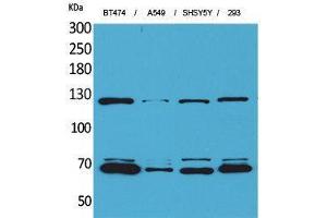 Western Blotting (WB) image for anti-K-Cadherin (CDH6) (Internal Region) antibody (ABIN3187664) (CDH6 antibody  (Internal Region))