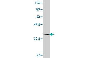 Western Blot detection against Immunogen (38. (PRPS2 antibody  (AA 160-269))