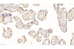 Immunohistochemistry (IHC) image for anti-Wingless-Type MMTV Integration Site Family, Member 3A (WNT3A) (AA 1-290) antibody (ABIN7427264)