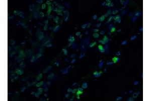 Image no. 2 for anti-Lamin A/C (LMNA) antibody (ABIN335390) (Lamin A/C antibody)