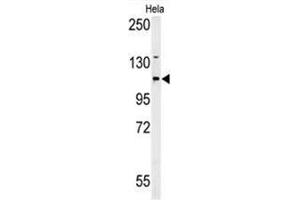 Western blot analysis of ADCY4 Antibody (Center) in Hela cell line lysates (35 µg/lane).