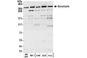anti-Senataxin (SETX) (AA 2627-2677) antibody