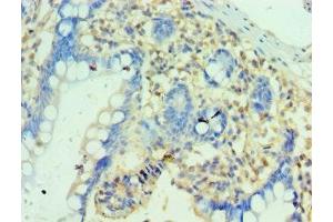 Immunohistochemistry of paraffin-embedded human small intestine tissue using ABIN7162868 at dilution of 1:100 (PTRH2 antibody  (AA 40-179))