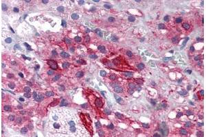 Human Adrenal (formalin-fixed, paraffin-embedded) stained with GRIK1 antibody ABIN343898 at 5 ug/ml followed by biotinylated goat anti-rabbit IgG secondary antibody ABIN481713, alkaline phosphatase-streptavidin and chromogen. (GRIK1 antibody  (Internal Region))