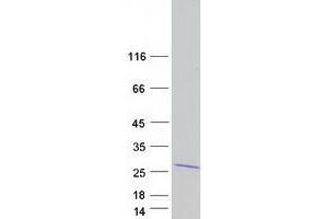 Western Blotting (WB) image for COMM Domain Containing 7 (COMMD7) (Transcript Variant 1) protein (Myc-DYKDDDDK Tag) (ABIN2712449)