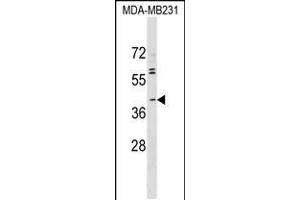 Western blot analysis in MDA-MB231 cell line lysates (35ug/lane). (ABO antibody  (N-Term))