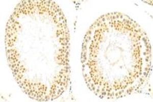 Immunohistochemistry analysis of paraffin-embedded rat testis using,SIN1 (ABIN7074669) at dilution of 1: 500 (MAPKAP1 antibody)