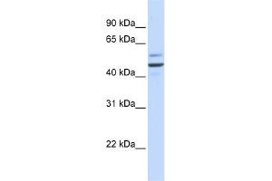WB Suggested Anti-GOLM1 Antibody Titration: 0. (GOLM1 antibody  (N-Term))